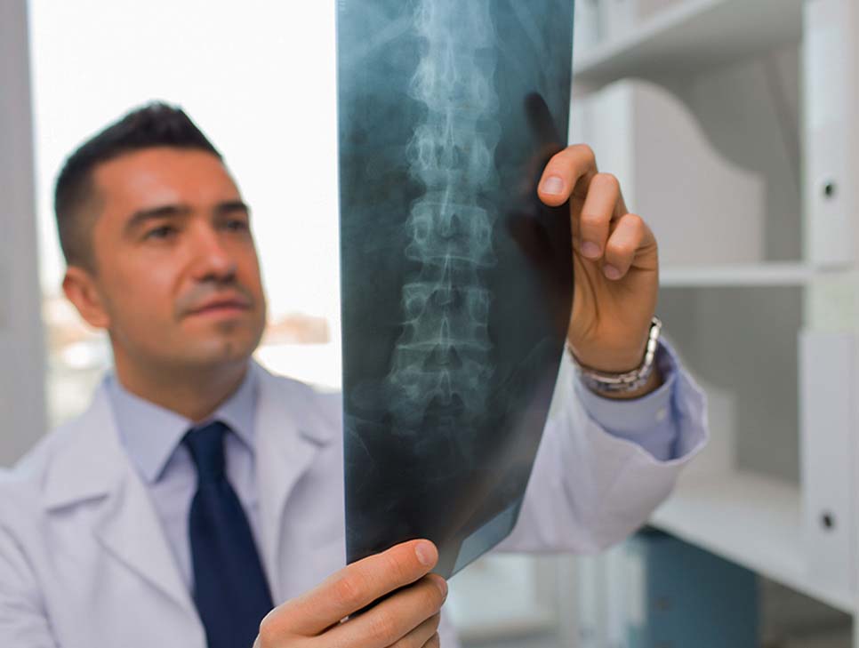 Doctor at South Bay Wellness Center examining patient x-rays for spine injury